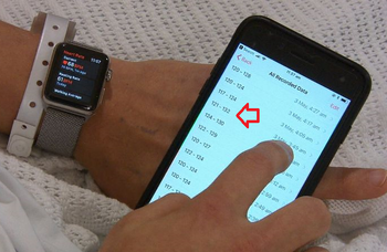 Apple Watch saves another life by notifying user of a heart problem