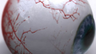 Doctor says Apple exaggerated claims on its "Retina Display"