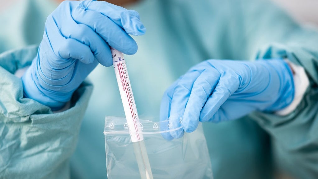 Apple and Google's coronavirus-tracing technology is ready