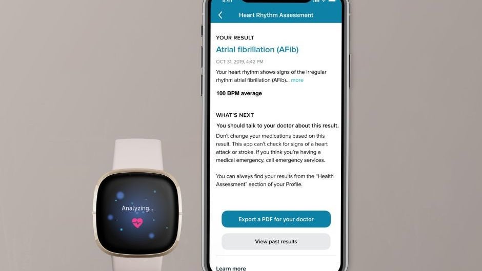 The best thing about the hot new Fitbit Sense smartwatch could be usable this year
