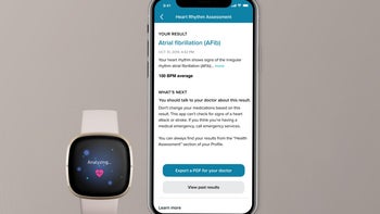 Fitbit takes the fight to Apple and Samsung with early ECG activation on the hot new Sense