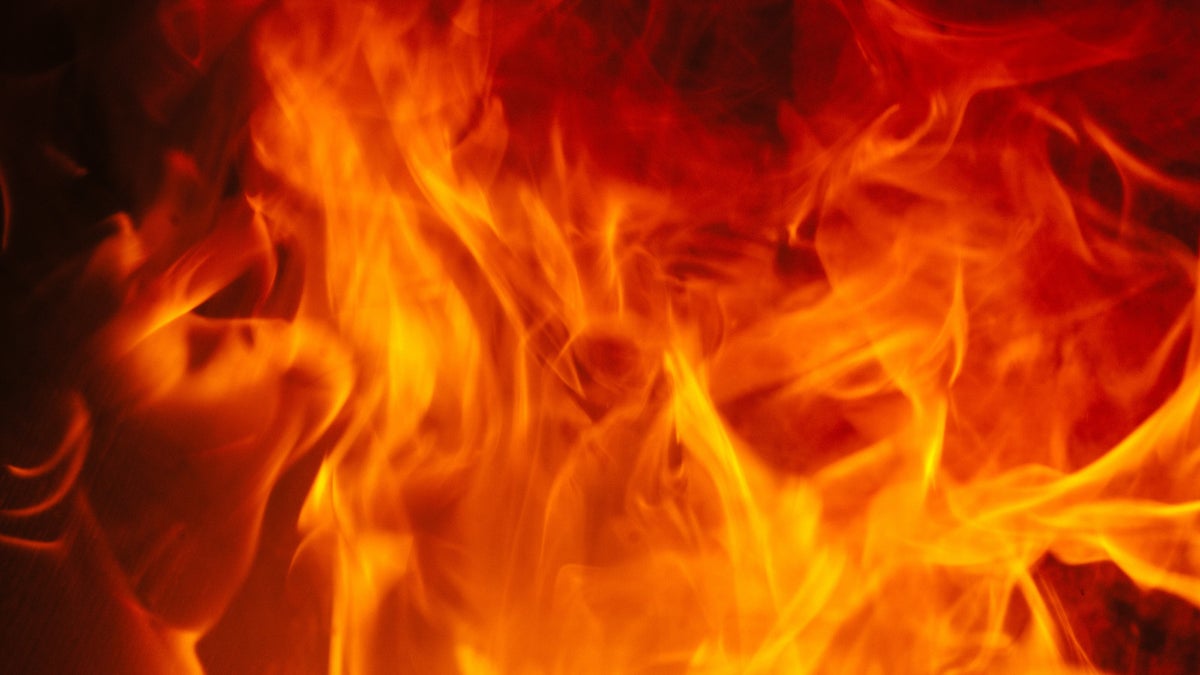 iPhone charger catches fire, leaving girl's face burned