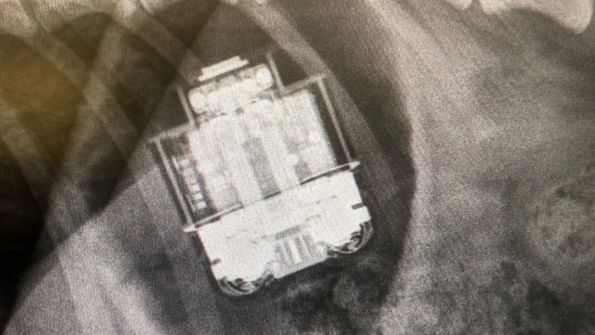 AirPods removed from dog's stomach, survive (the dog too)