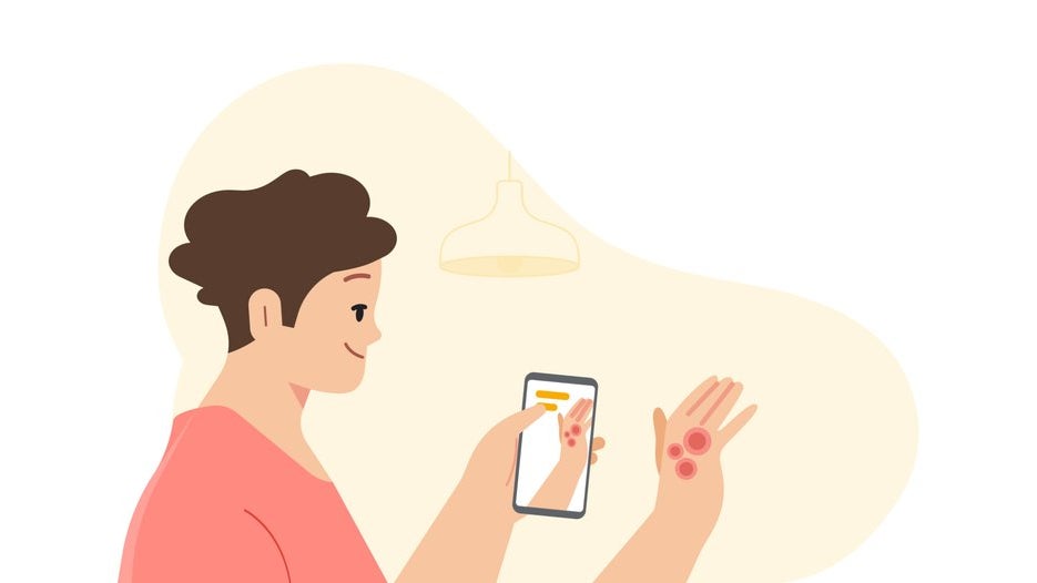 Google introduces an AI tool that diagnoses skin conditions