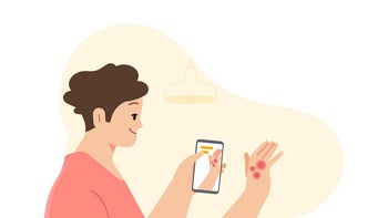 Google introduces an AI tool that diagnoses skin conditions