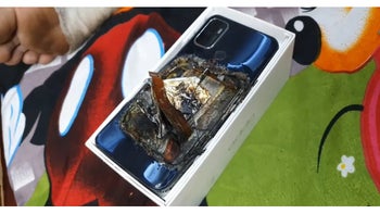 Oppo A53 explodes in man's pocket, leaving him severely injured