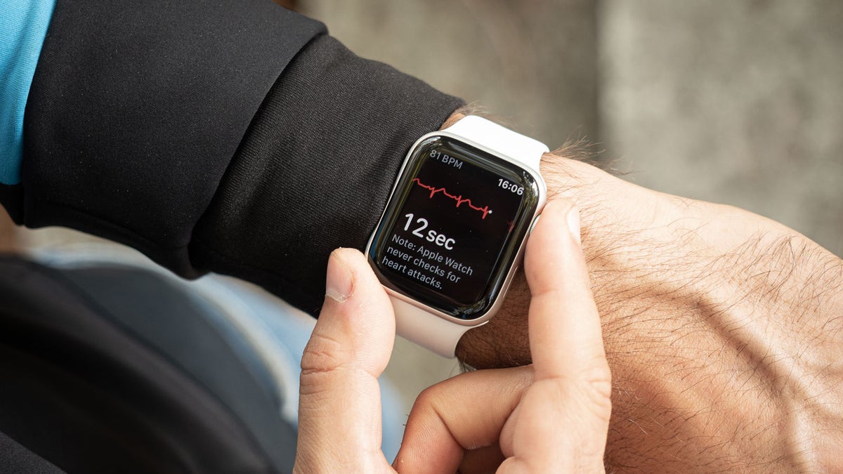 Apple brings Apple Watch ECG features to 30 more countries with watchOS 7.6 update