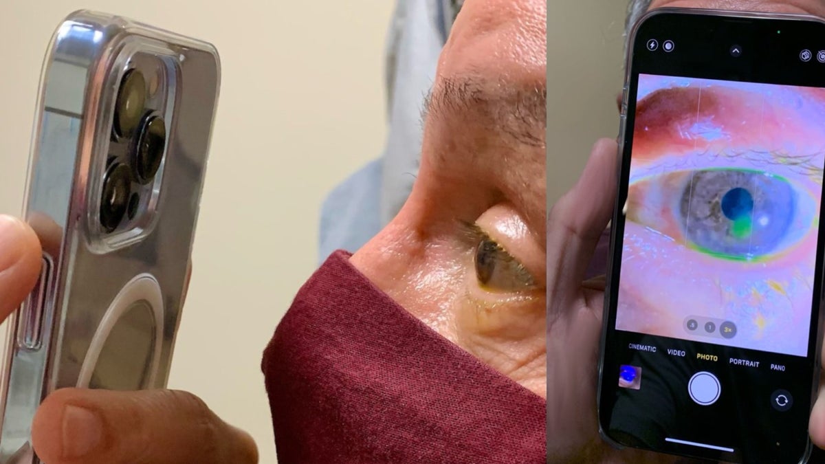 Doctor defends himself for using iPhone 13 Pro macro feature at work