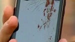 Man claims Motorola DROID 2 exploded leaving him injured