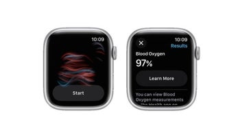 Apple Watch pulse oximeter, knocked by Masimo's CEO, saves the life of an airline passenger