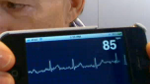 Monitor your heart with the iPhonECG to be introduced at CES next week