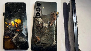 Galaxy S26 explodes in owner's pocket, causing severe burns to hands and body