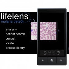 Hope for malaria infected: Lifelens app gives 94% accurate diagnosis on your smartphone from a drop