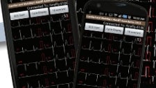 Portable CardioCard Mobile EKG machine comes with an Android app