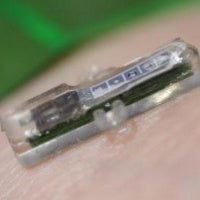 This tiny implant that monitors your blood will work with your smartphone to warn you about heart at