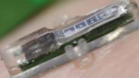 This tiny implant monitors your blood and will work with your smartphone to warn you about heart attacks