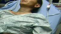 Not again! Second man takes selfie with rattlesnake and ends up in the hospital