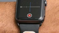 Former Google+ boss is making a heart rate monitor for the Apple Watch