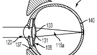 Forget Glass; Google wants to plant Android right in your eye