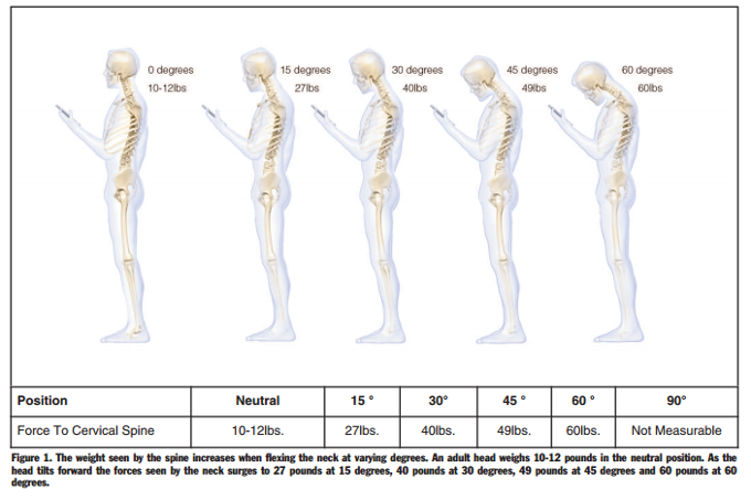 Spending way too much time on your smartphone? Get ready for a spine surgery, warn researchers