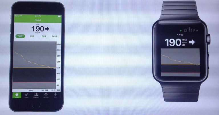 DexCom's blood glucose app for the Apple iPhone (L) and the Apple Watch"&nbsp - Company designing app for Apple Watch that graphs users blood glucose levels