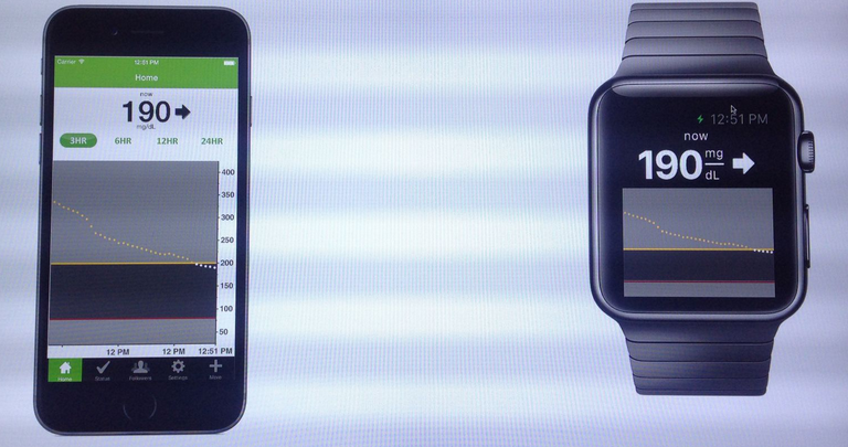 DexCom&#039;s blood glucose app for the Apple iPhone (L) and the Apple Watch&quot;&amp;nbsp - Company designing app for Apple Watch that graphs users blood glucose levels