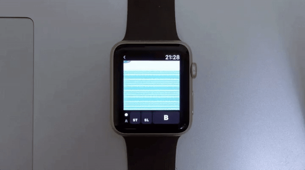 Someone made classic Pokemon Yellow run on the Apple Watch