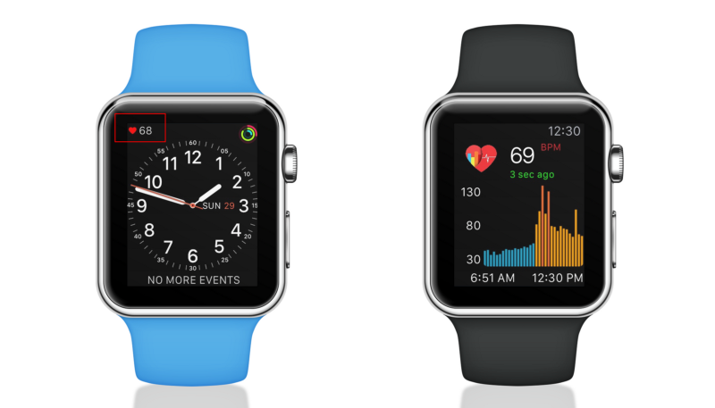 Study: Apple Watch is 97% accurate when detecting one of the common causes of heart failure