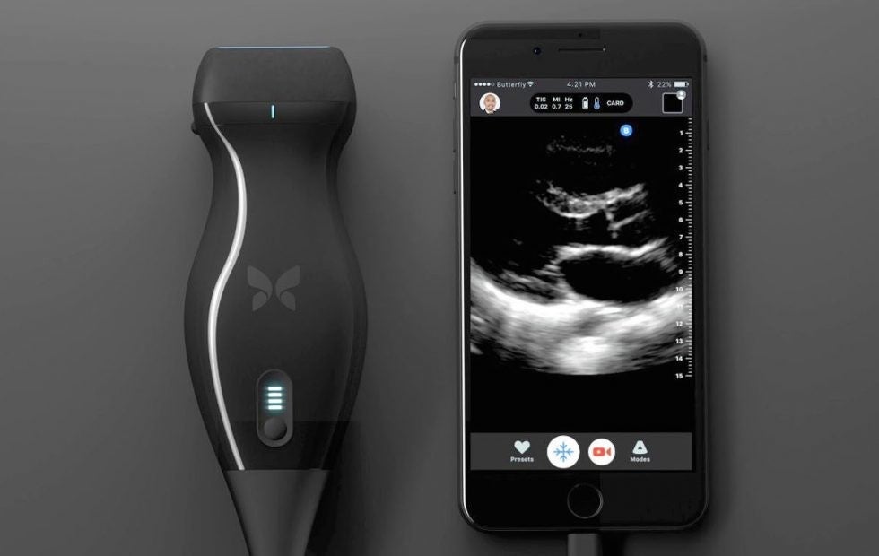 The Butterfly IQ sends ultrasound images to an Apple iPhone - Surgeon discovers his own cancer after using an ultrasound connected to an iPhone
