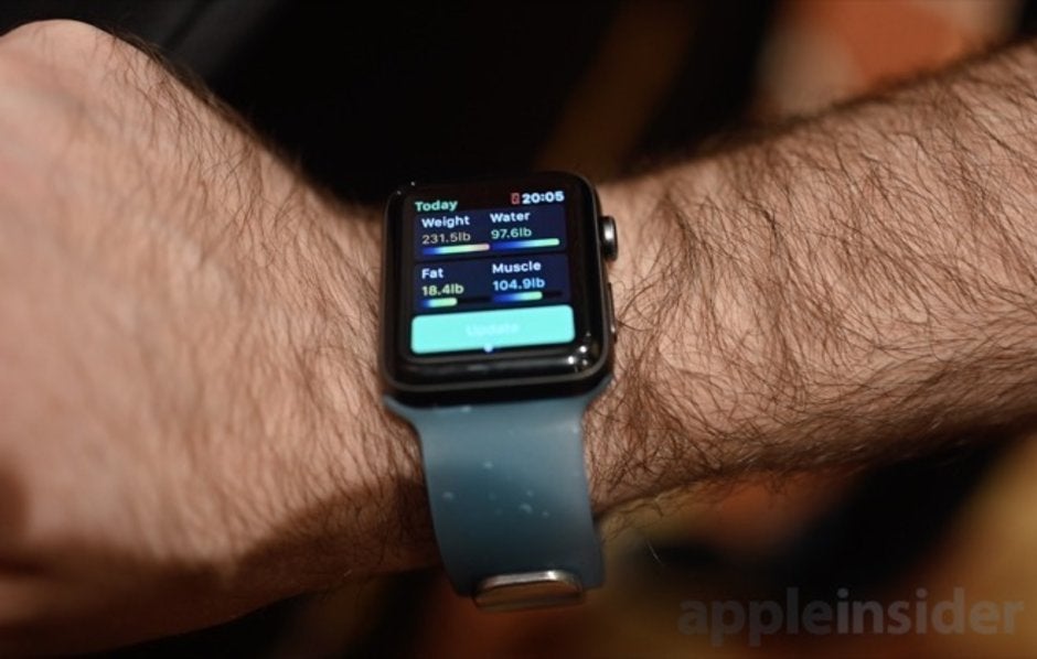 The Aura Band for the Apple Watch will track your weight, and body composition - Aura Band for the Apple Watch tracks body composition, weight and more
