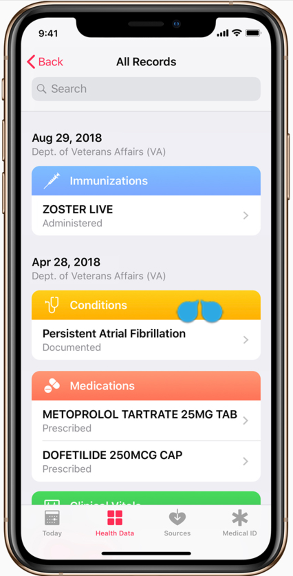 Vets will soon be able to see their aggregated medical records on an Apple iPhone - Apple is breaking down the barrier between patients and doctors starting with this news