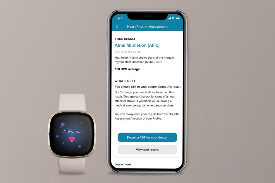 The Fitbit Sense will match the Apple Watch's ECG capabilities next month
