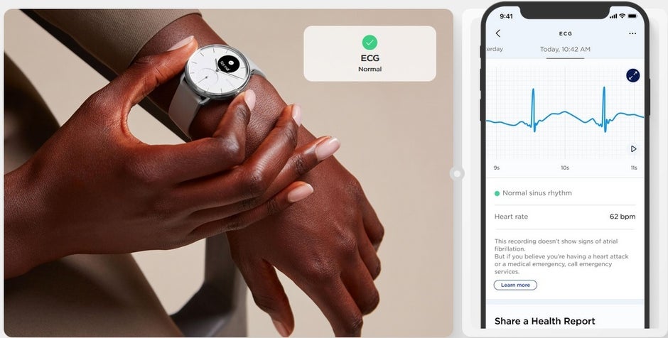 In only 30 seconds, the ScanWatch will monitor your heart for abnormal rhythms - ScanWatch now available in the states delivering medical-grade ECG, SpO2 readings