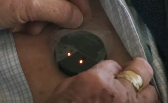 Saklar Sinkron di dada pasien mengontrol sensor di otak pasien - Terobosan medis memungkinkan pasien mengetuk layar iPad dengan pikiran mereka