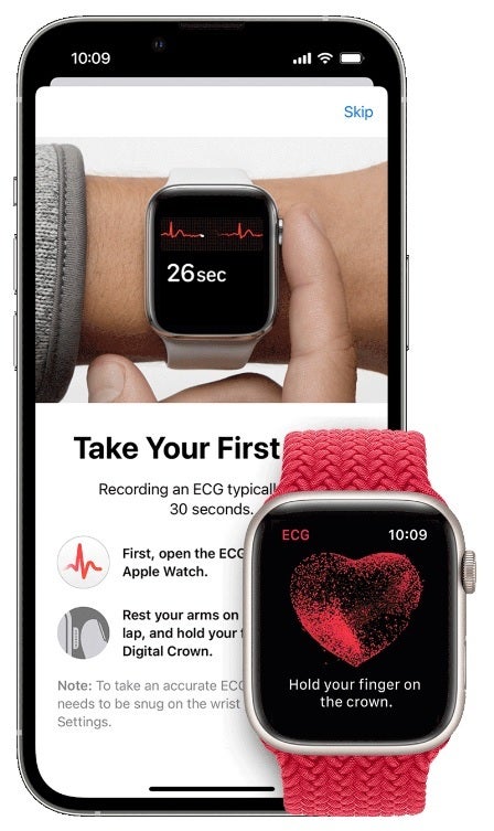 Survey shows ECG on Apple Watch could be used to predict stress: Study shows ECG sensor on Apple Watch could notify users of rising stress levels
