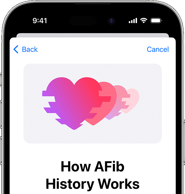 Image Credit–Apple - Apple Watch&#039;s AFib History feature gets the FDA nod as a reliable tool