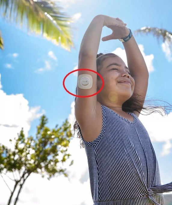 The Dexcom G7 sensor is worn on the back of the arm - Apple Watch can now show you near real-time blood glucose readings although there is a huge catch