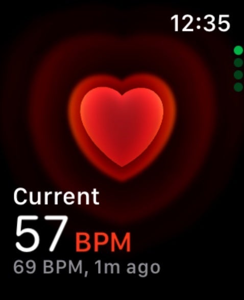 The Heart Rate monitor on the Apple Watch became Sue Dumbauld&#039;s must-see viewing 24/7. | Image credit-PhoneArena - Woman&#039;s Apple Watch gives her serious heart rate warning prior to open heart surgery