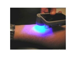 Nanosensor tattoo for bloodless glucose metering - Smartphones and tablets as medical devices