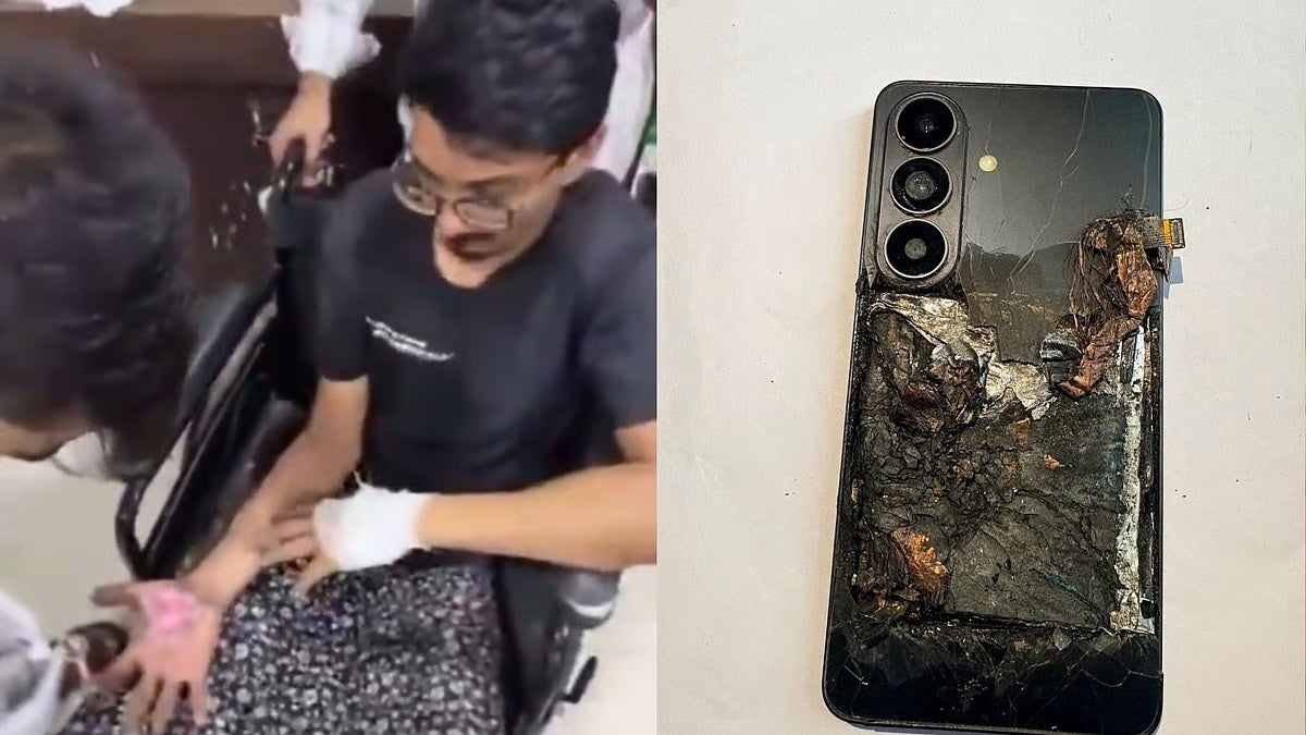 The injured man next to the phone's remains. | Image by X - Galaxy S26 explodes in owner's pocket, causing severe burns to hands and body