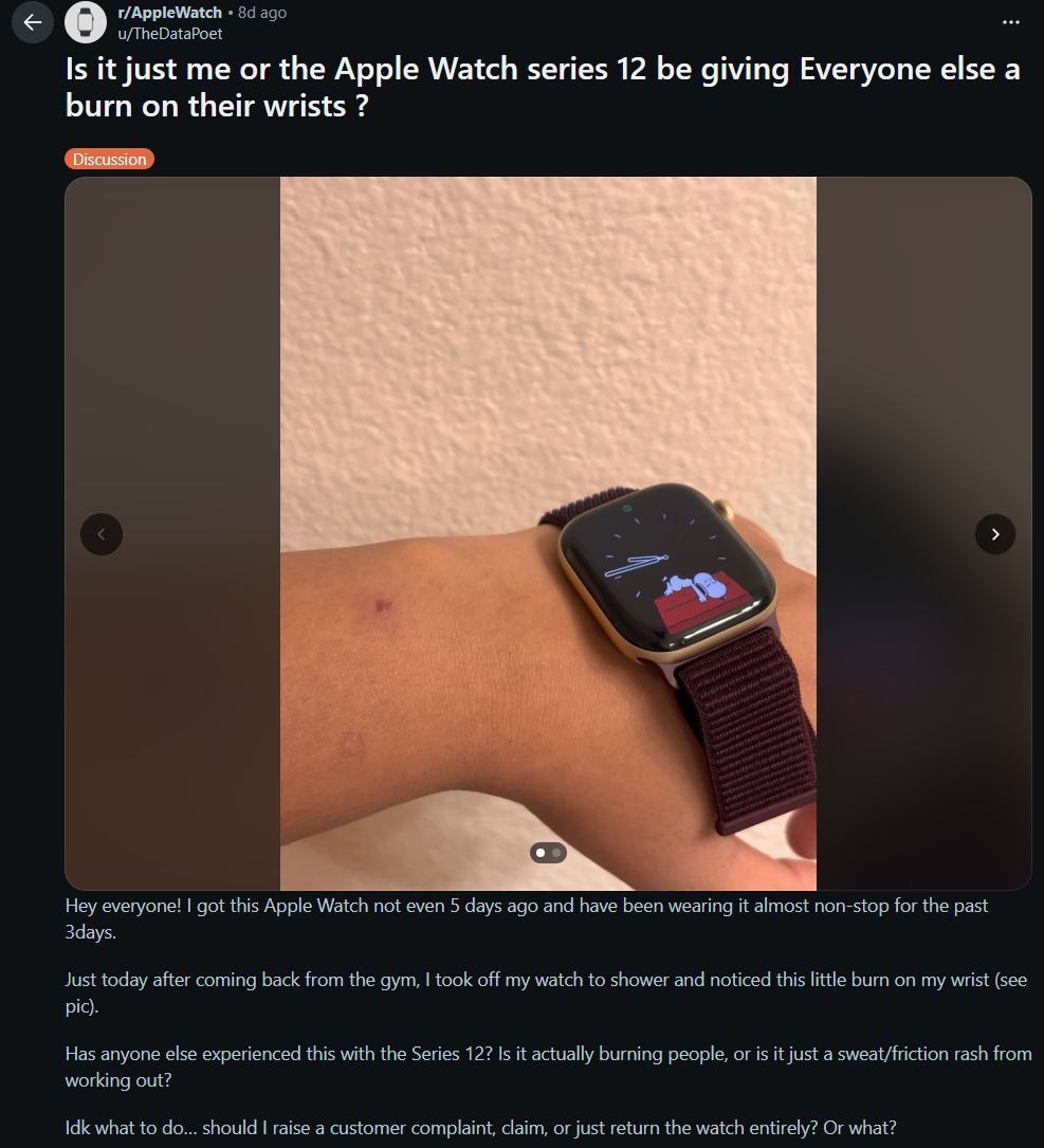Apple Watch 12 user reported a strange skin irritation on Reddit. | Image by Reddit - Has Apple made a major design mistake with the Series 12 and Ultra 4?