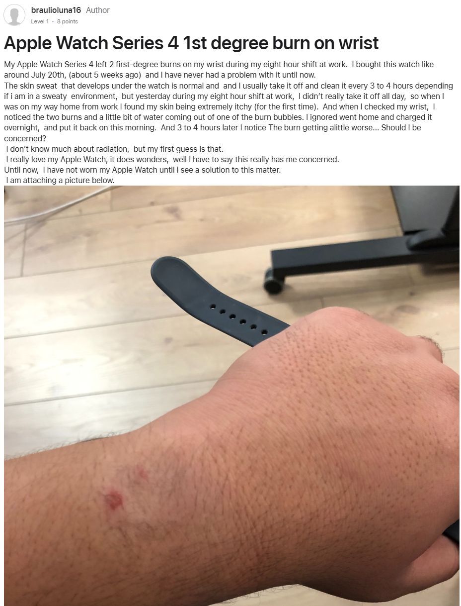 One Apple Watch Series 3 owner reported a first-degree burn on the Apple forums back in 2019. | Image by Apple - Has Apple made a major design mistake with the Series 12 and Ultra 4?