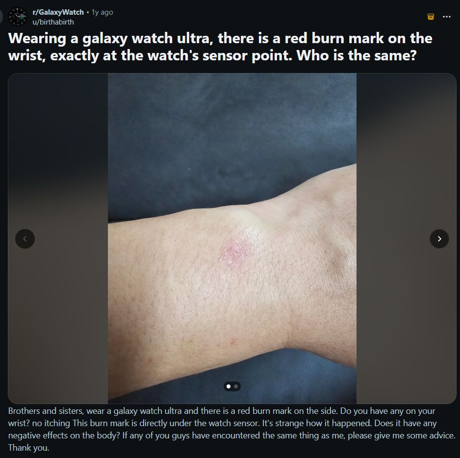 This burn mark is directly under the watch sensor of the Galaxy Watch Ultra. | Image by Reddit - Has Apple made a major design mistake with the Series 12 and Ultra 4?